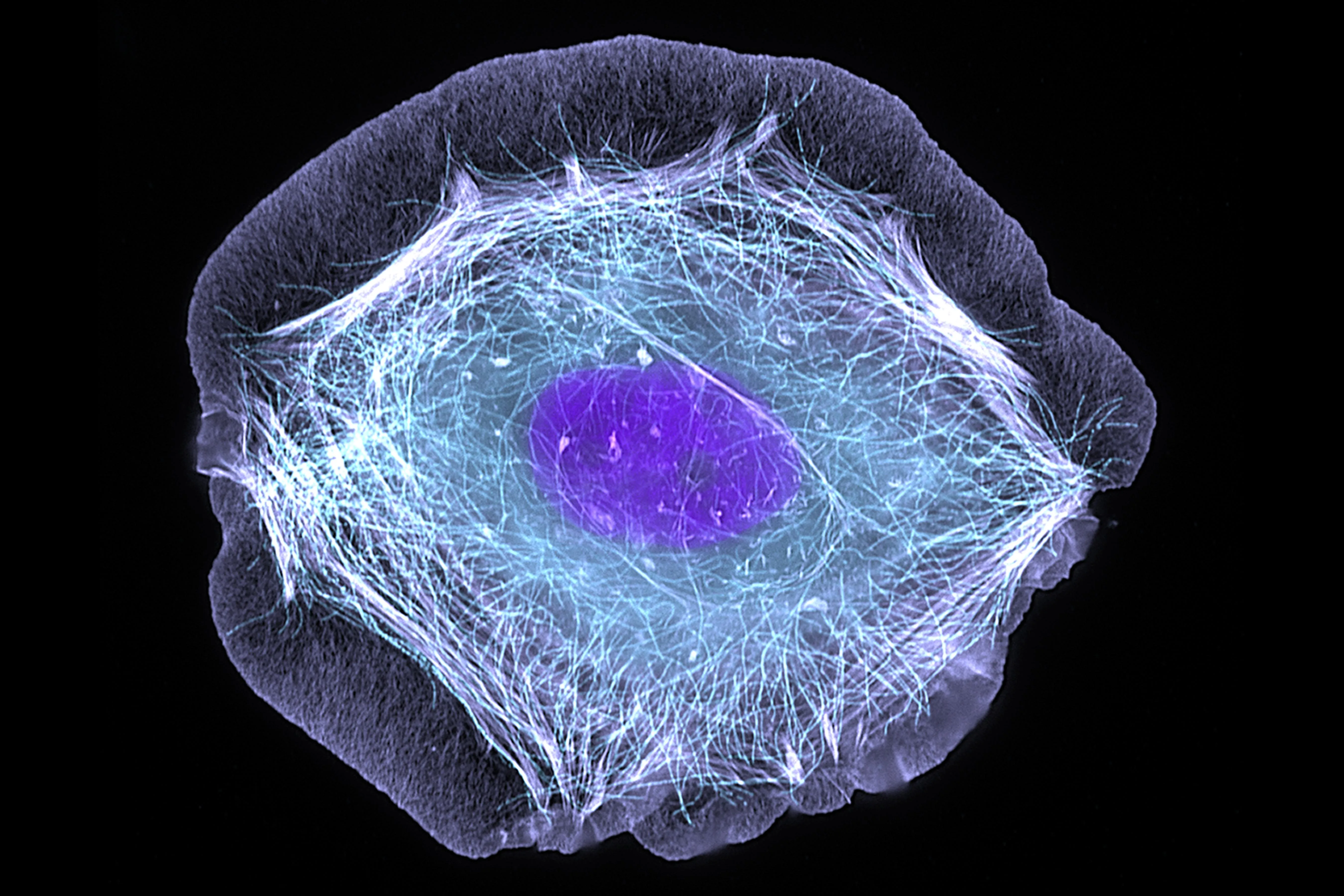 Citoesqueleto de uma célula da pele humana revelado por fluorescência, com microtúbulos e filamentos de actina ao redor do núcleo